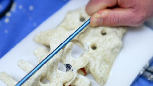 Dummy of spine with the tools applied to it. Educators demonstrating the usage of modern instruments during neurosurgical operation.