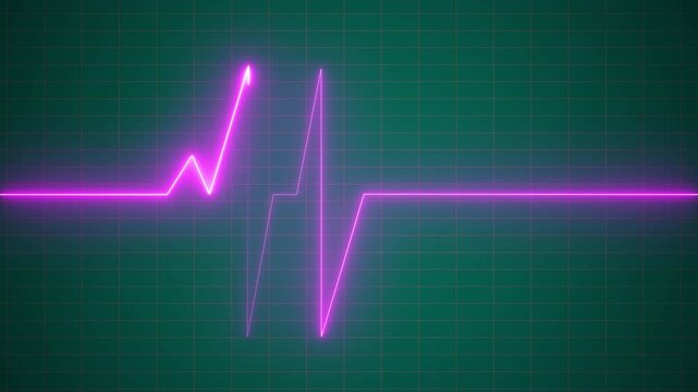 Heartbeat Animation monitoring footage seamless line 4K.The Importance of ECG Monitoring in Heart Health Assessment.


