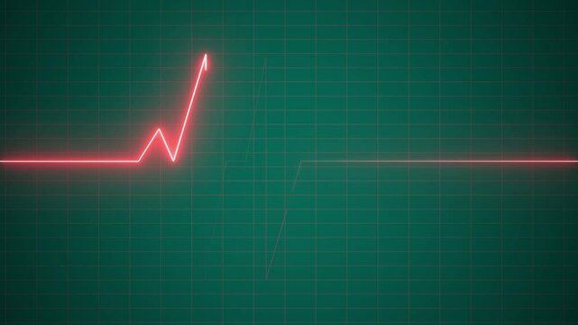 Heartbeat Animation monitoring footage seamless line 4K.The Importance of ECG Monitoring in Heart Health Assessment.


