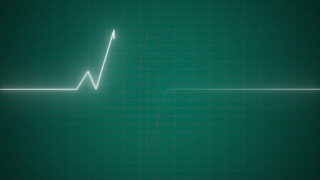 Heartbeat Animation monitoring footage seamless line 4K.The Importance of ECG Monitoring in Heart Health Assessment.


