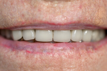 Fototapeta premium Close-Up of Aged Smile