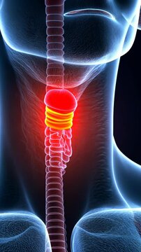 Detailed depiction of the human thyroid gland and surrounding anatomy in a medical illustration