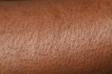 Macro view of normal skin as background