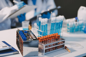 Microbiological research with a test tube and micropipette in close -up