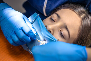 The dentist treats the child's tooth using a rubber dam. Close-up of tooth treatment.