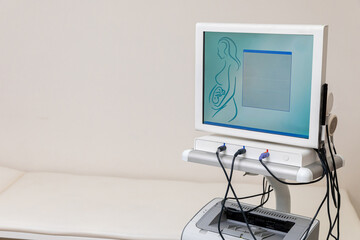 Electronic Cardiotocography Machine Monitoring Fetal Heart Contractions Of Uterus. Printing...