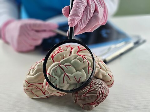 Neurologist with model of human brain anatomy and magnifying glass
