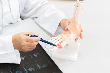 Orthopedist explain to the patient for human foot bone injury treatment program.Doctor showing to feet fingle bone anatomy and film x ray bone.Physiotherapy present foot model for injured athlete.