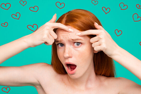 Anti acne. Close-up portrait of worried nude natural nice attractive red-haired girl with shiny pure clean skin, touching forehead, oiled skin, isolated over green turquoise background
