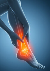 足の痛み｜患部｜足首｜イラスト素材｜Foot pain | Affected area | Ankle | Illustration material 