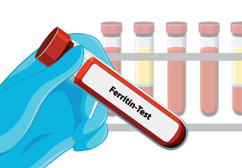 Medical Blood Test Illustration