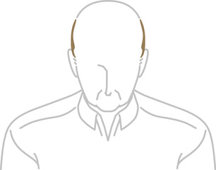 AGA：正面から見た薄毛のミドル男性（俯瞰）