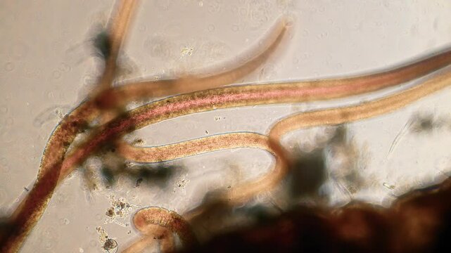 The amazing world of microbiology. Different bacteria, microbes and single-celled microorganisms are visible through a microscope. High-quality video.