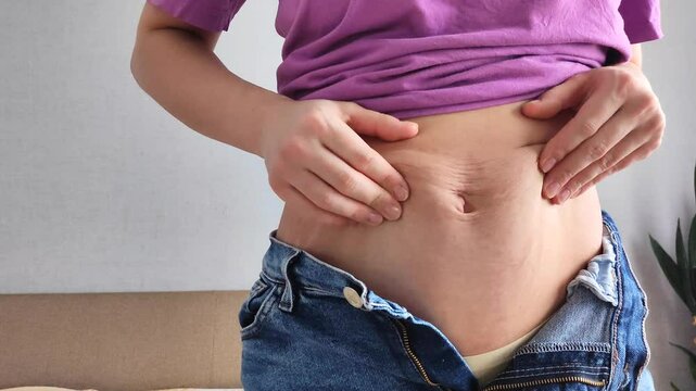 Woman's body after pregnancy and childbirth. Hands touching skin. Fat deposits on the abdomen. After pregnancy, childbirth and cesarean section. Excess weight and stretch marks on the skin
