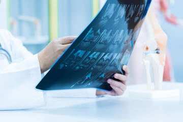 Doctor holding patient bone x-ray film before surgery.Image MRI and CT scan at radiology orthopedic department in hospital.Knee join xray for treatment.Physiotherapy teach model for injured athlete.