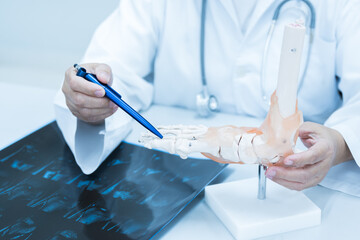Orthopedist explain to the patient for human foot bone injury treatment program.Doctor showing to...