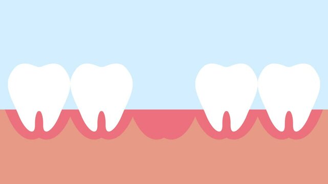 Animation of tooth extraction by dental tools 4K animation background video