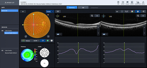 Optical Coherence Tomography (OCT) image of eye in the patient. Ophthalmic test - OCT optical coherence tomography measurement. SLO Scan view of the macula in retina with vessels.