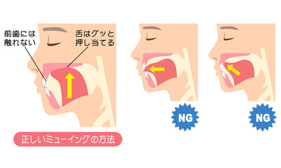 正しいミューイングの方法　適正な舌の位置と誤った舌の位置 © koti