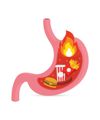 Human stomach with pain from fast food inside, symptoms of gastritis stock illustration