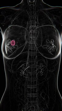 Female Right Side Chest X-ray Vertical Video | Cancer Indication Right side Concept Video | Lungs Cancer | X-ray of Mammary Glands