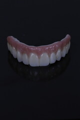 dental prosthetics veneers implant