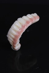 dental prosthetics veneers implant