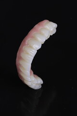 dental prosthetics veneers implant