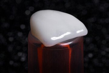 dental prosthesis veneers implant
