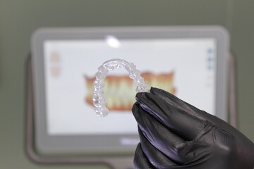 dental prosthesis veneers implant