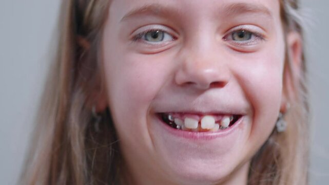 Smiling little girl showing metallic teeth and making a funny face, closeup portrait, looking at the camera with a joyful expression