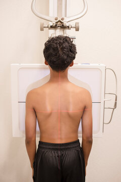 Close up of patient getting an x-ray on back