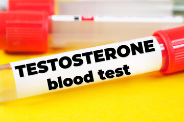 Testosterone Blood Test text meaning analysis
