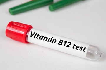 Vitamin B12 Test name of blood test
