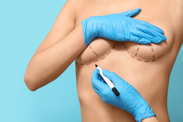 Doctor drawing marks on female breast before cosmetic surgery operation against blue background
