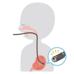 胃カメラ検査を受けるシンプルな人物の横顔イラスト