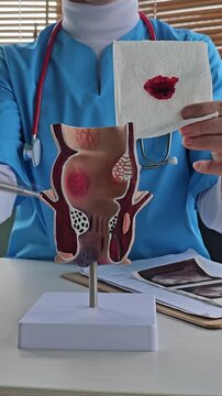 Proctologist and rectum and napkin with blood. Rectal bleeding Rectal bleeding causes, symptoms 