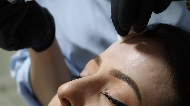 woman botox application 