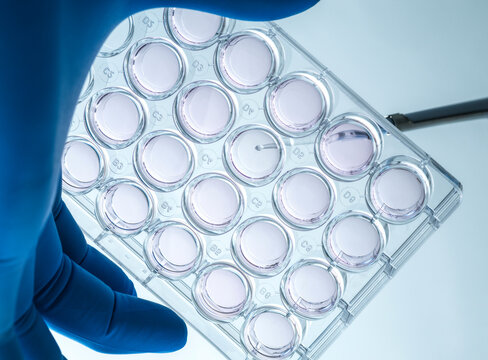 Biomedicine, Scientist preparing cells in growth medium in the lab