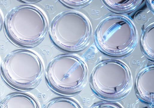 Biomedicine, Scientist preparing cells in growth medium in the lab