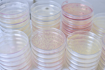Colonies of bacteria growth on agar plate medium in laboratory.	
