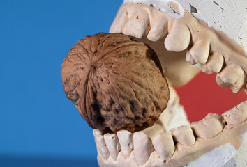 Whole walnut in artificial plaster jaw on blue background