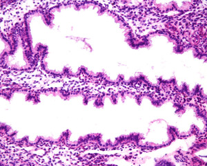Human endometrium. Secretory phase