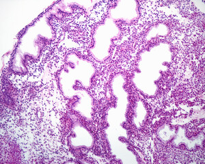 Human endometrium. Secretory phase