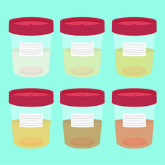 Urine test color chart