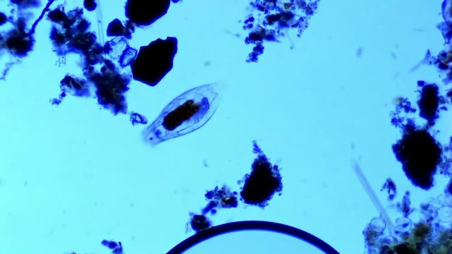 Notholca spp. under microscope - 100X