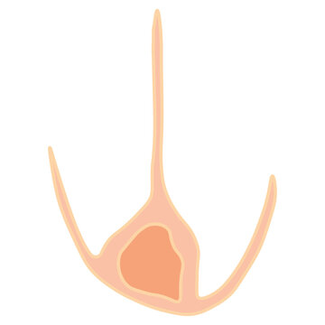 ceratium  dinoflagellates