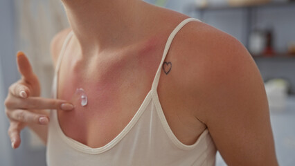 Woman applying lotion on sunburned skin at a wellness spa in a serene room with indoor lighting