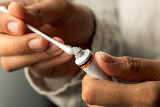 Applying ointment using a cotton bud