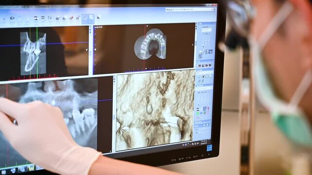 Dentist touching the computer screen at teeth x-ray in a dentist office